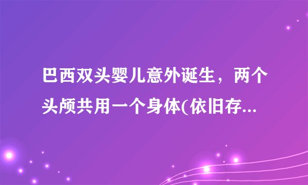巴西双头婴儿意外诞生，两个头颅共用一个身体(依旧存活)-飞外网