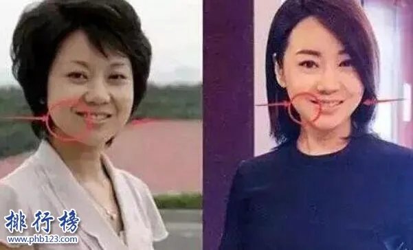 娱乐圈十大承认整容明星,最后一个让人唏嘘不已