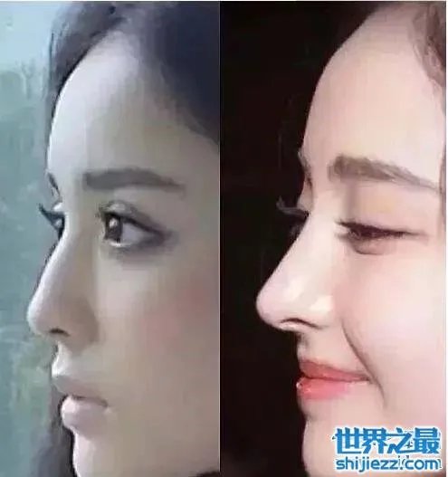 古力娜扎整容前后照片,变化之大让人惊呆