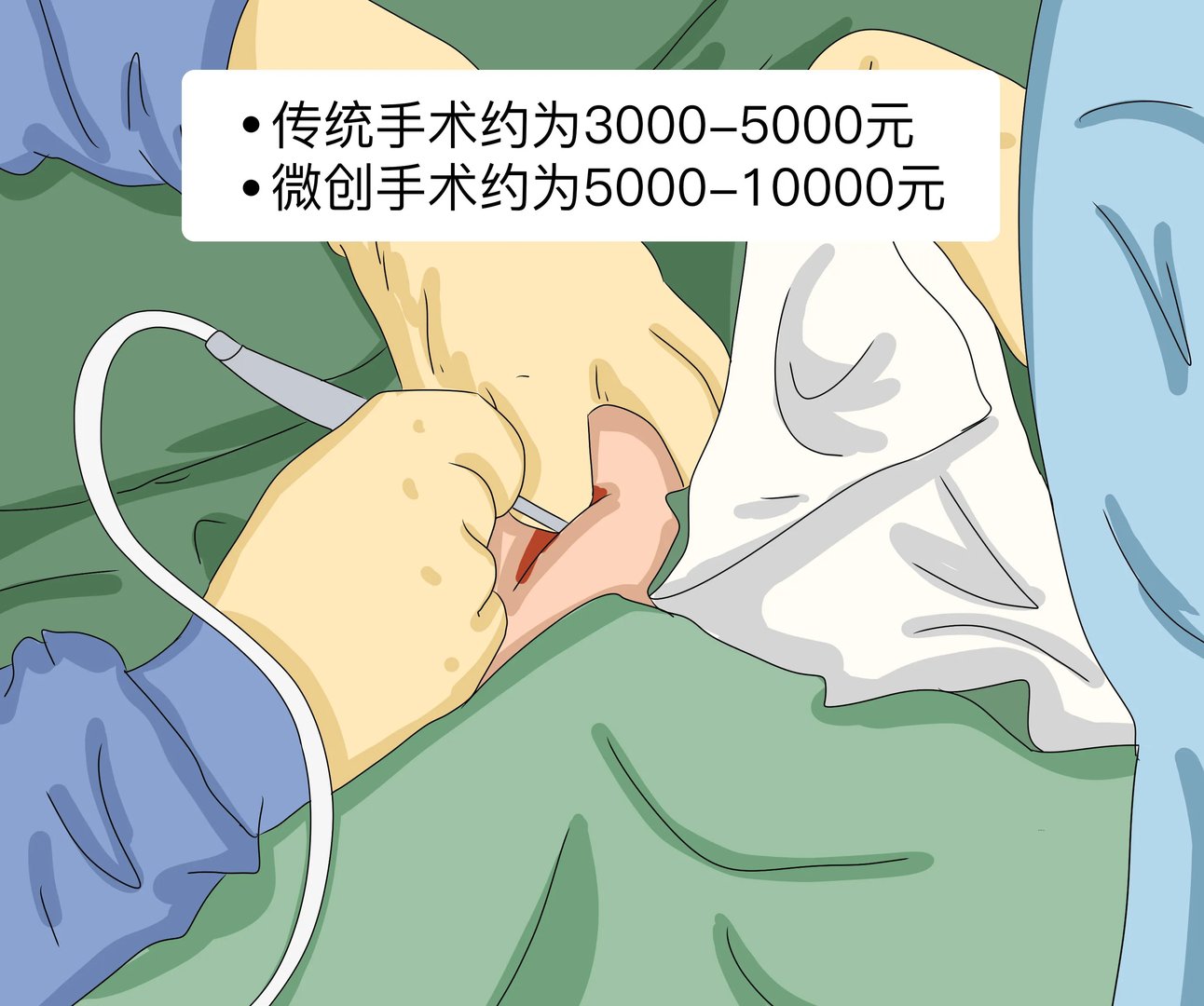 痔疮切除大概需要多少钱