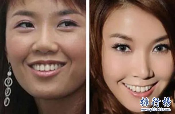 娱乐圈十大承认整容明星,最后一个让人唏嘘不已