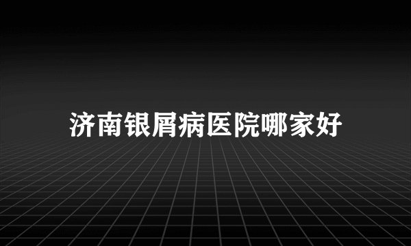济南银屑病医院哪家好
