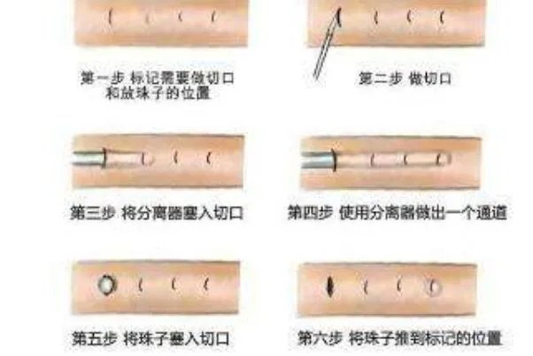入珠是什么意思?男性的小弟弟镶嵌珠子(加强战斗力)