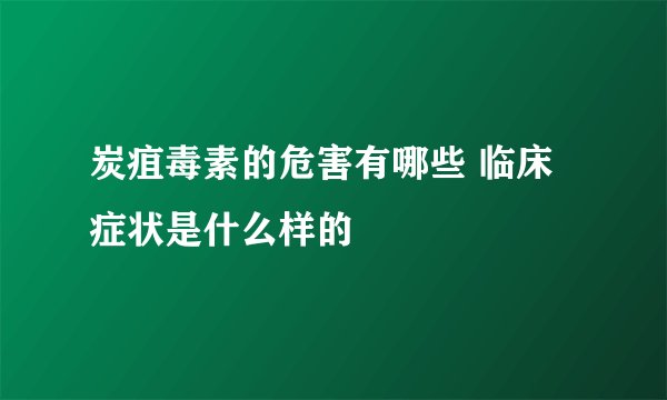 炭疽毒素的危害有哪些 临床症状是什么样的