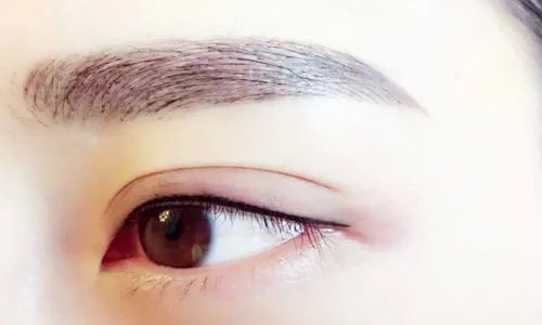 开眼角加双眼皮价格
