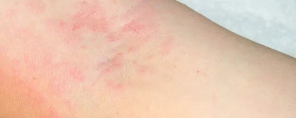 相关推荐