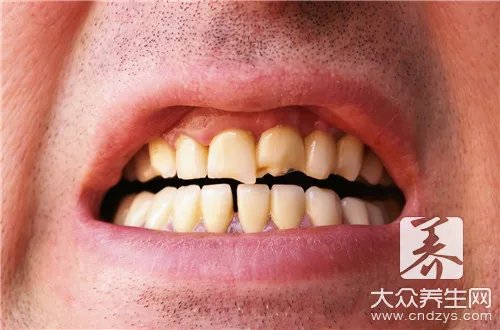 皮罗氏综合征