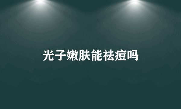 光子嫩肤能祛痘吗
