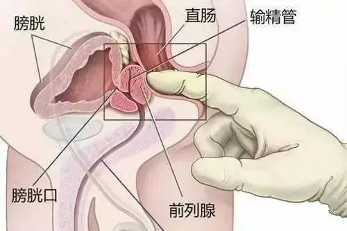 前列腺位置高清图