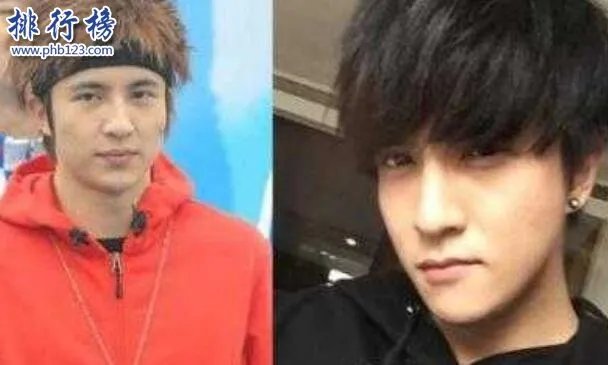 娱乐圈十大承认整容明星,最后一个让人唏嘘不已