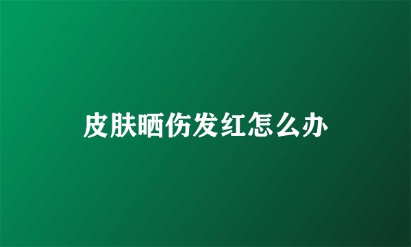皮肤晒伤发红怎么办