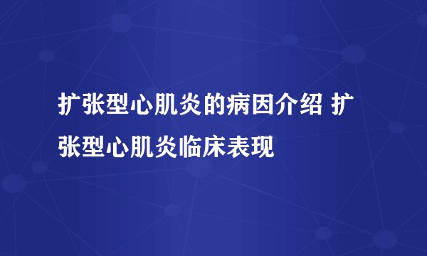 扩张型心肌炎的病因介绍 扩张型心肌炎临床表现