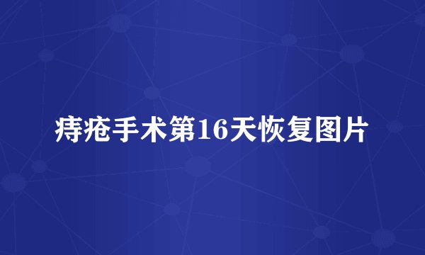 痔疮手术第16天恢复图片