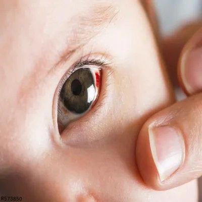 先天性眼球震颤该如何治疗