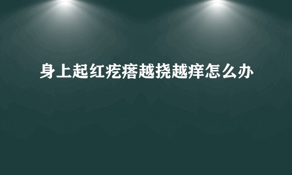 身上起红疙瘩越挠越痒怎么办