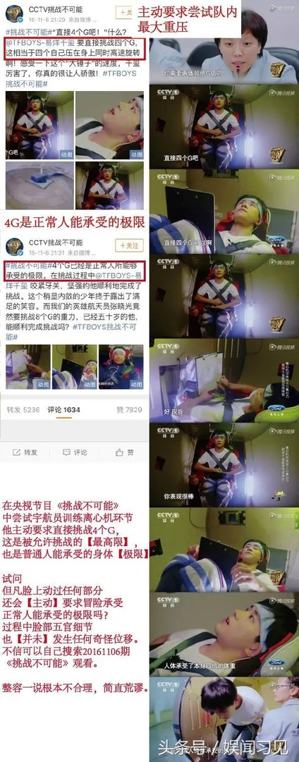 易烊千玺整容了吗?