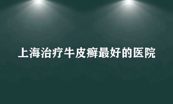 上海治疗牛皮癣最好的医院