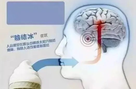 冰淇淋吃多了会头疼，是因为患上了“脑结冰”？