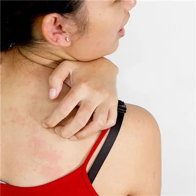 干燥综合症的症状?