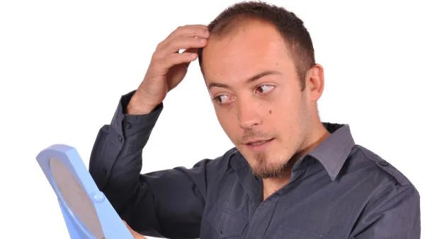 什么是肾虚型脱发