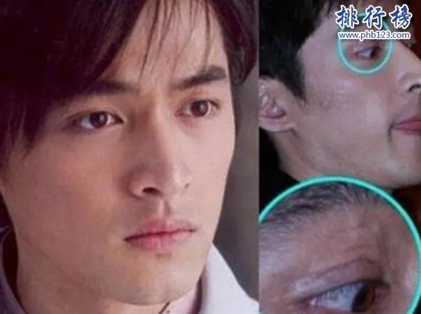 娱乐圈十大承认整容明星,最后一个让人唏嘘不已