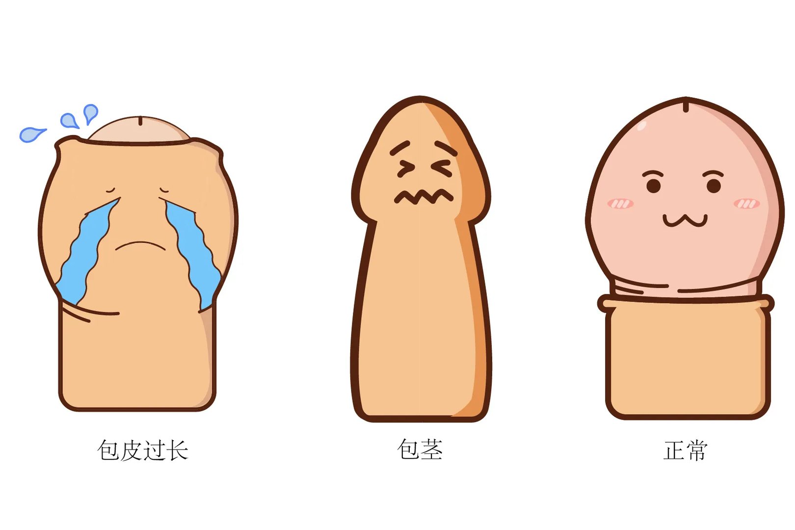 男生包茎图片