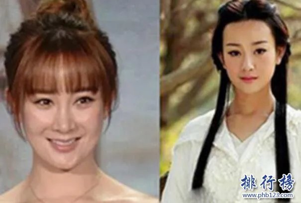 娱乐圈十大承认整容明星,最后一个让人唏嘘不已