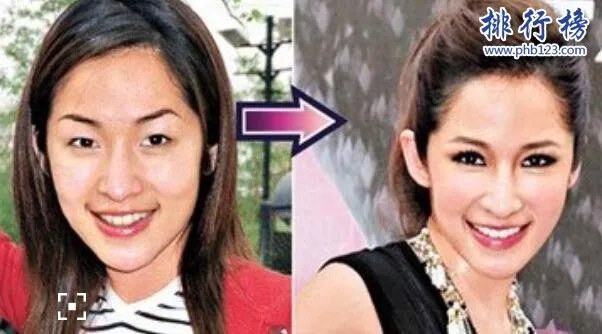 娱乐圈十大承认整容明星,最后一个让人唏嘘不已