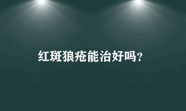 红斑狼疮能治好吗?