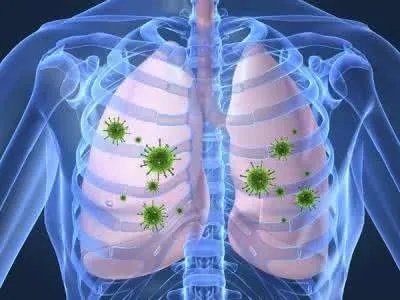 肺癌原发肿瘤的症状体征