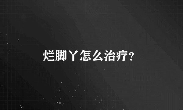 烂脚丫怎么治疗？