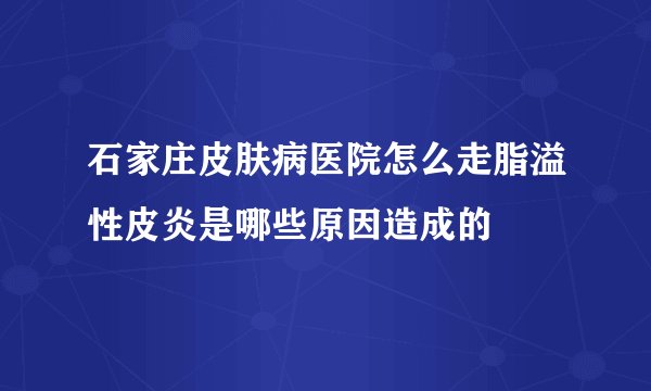石家庄皮肤病医院怎么走脂溢性皮炎是哪些原因造成的