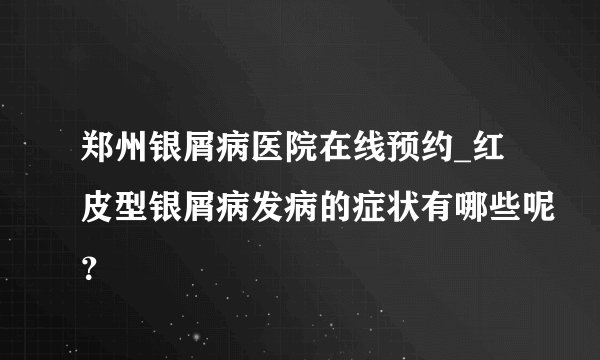郑州银屑病医院在线预约_红皮型银屑病发病的症状有哪些呢？