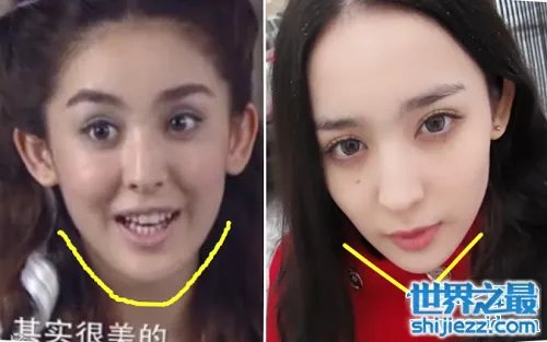 古力娜扎整容前后照片,变化之大让人惊呆